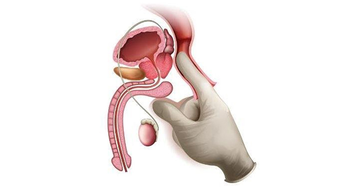 前立腺の位置の図